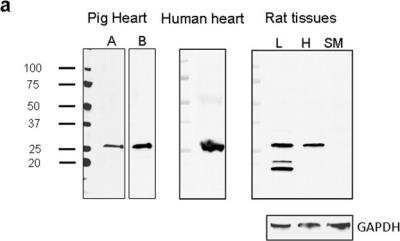 Western Blot: Connexin 26/GJB2 AntibodyBSA Free [NBP2-41304]