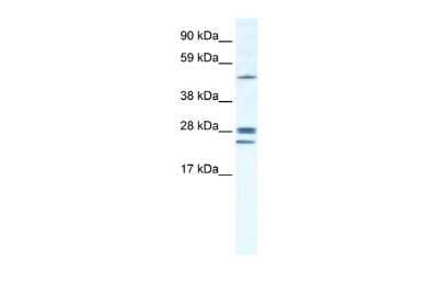 Western Blot: Connexin 26/GJB2 Antibody [NBP2-88789]