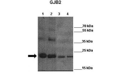 Western Blot: Connexin 26/GJB2 Antibody [NBP2-88789]