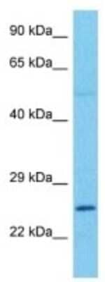 Western Blot: Connexin 26/GJB2 Antibody [NBP3-10835]