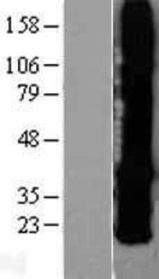 Western Blot: Connexin 26/GJB2 Overexpression Lysate [NBP2-04260]