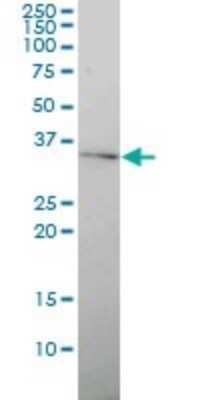 Western Blot: Connexin 30.3/GJB4 Antibody (1E3-1C12) [H00127534-M01]