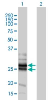 Western Blot: Connexin 30.3/GJB4 Antibody (1E3-1C12) [H00127534-M01]