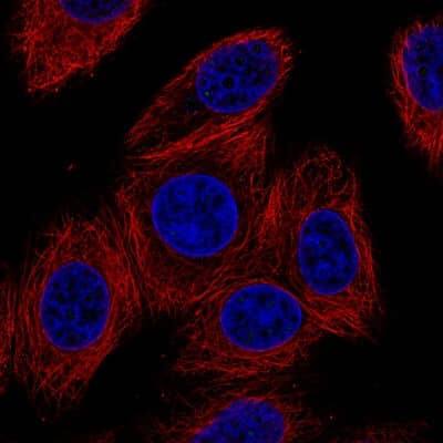 Immunocytochemistry/ Immunofluorescence: Connexin 30/GJB6 Antibody (CL4540) [NBP2-61141]