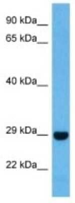 Western Blot: Connexin 30/GJB6 Antibody [NBP3-10836]