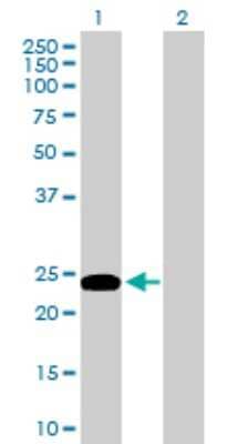 Western Blot: Connexin 30.1/GJB5 Antibody [H00002709-B01P]