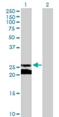 Western Blot: Connexin 30.1/GJB5 Antibody [H00002709-B02P]