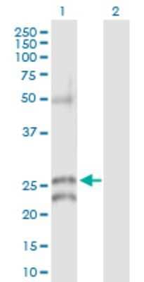 Western Blot: Connexin 30.1/GJB5 Antibody [H00002709-D01P]