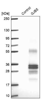 Western Blot: Connexin 30.1/GJB5 Antibody [NBP1-84333]