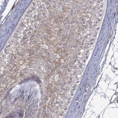 Immunohistochemistry-Paraffin: Connexin 30.3/GJB4 Antibody [NBP3-17078]