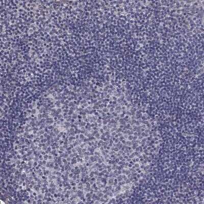 Immunohistochemistry-Paraffin: Connexin 30.3/GJB4 Antibody [NBP3-17078]