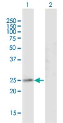 Western Blot: Connexin 30.3/GJB4 Antibody [H00127534-B01P]