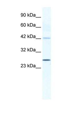 Western Blot: Connexin 30.3/GJB4 Antibody [NBP1-70506]