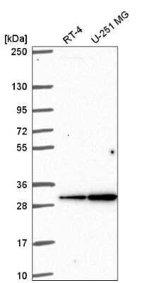 Western Blot: Connexin 30.3/GJB4 Antibody [NBP2-55398]