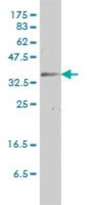 Western Blot: Connexin 31/GJB3 Antibody (3B4-1B3) [H00002707-M01]