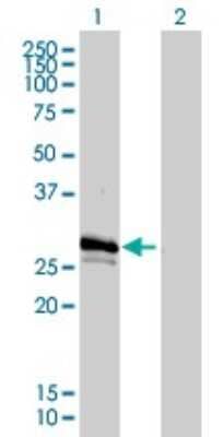 Western Blot: Connexin 31/GJB3 Antibody (3B4-1B3) [H00002707-M01]