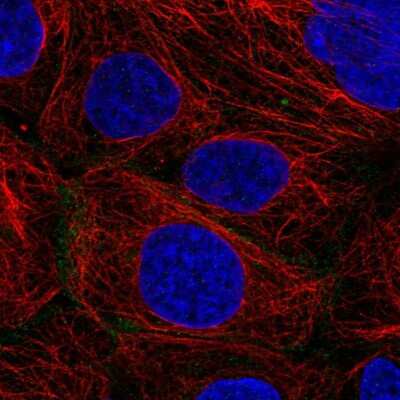 Immunocytochemistry/ Immunofluorescence: Connexin 31/GJB3 Antibody [NBP2-57376]