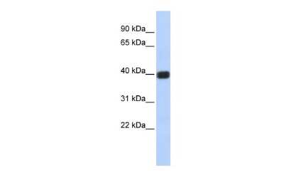 Western Blot: Connexin 36/GJD2 Antibody [NBP1-59254]