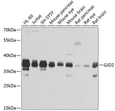 Western Blot: Connexin 36/GJD2 AntibodyBSA Free [NBP2-92416]