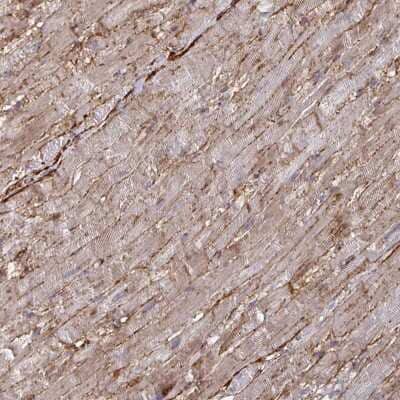 Immunohistochemistry: Connexin 37/GJA4 Antibody [NBP2-48886]