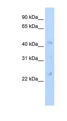 Western Blot: Connexin 37/GJA4 Antibody [NBP1-80512]