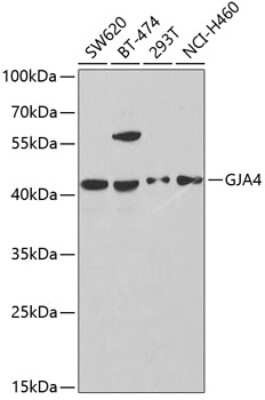 Western Blot: Connexin 37/GJA4 AntibodyBSA Free [NBP2-92410]