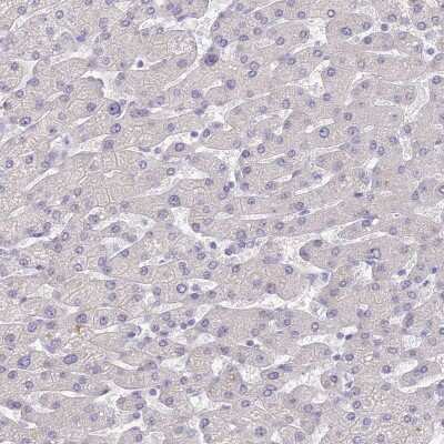 Immunohistochemistry-Paraffin: Connexin 43/GJA1 Antibody [NBP2-38234]