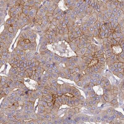 Immunohistochemistry-Paraffin: Connexin 43/GJA1 Antibody [NBP2-38234]