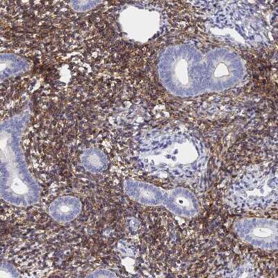 Immunohistochemistry-Paraffin: Connexin 43/GJA1 Antibody [NBP2-38234]