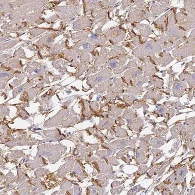 Immunohistochemistry-Paraffin: Connexin 43/GJA1 Antibody [NBP2-38234]