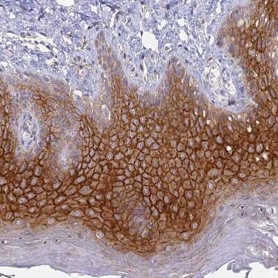 Immunohistochemistry-Paraffin: Connexin 43/GJA1 Antibody [NBP2-38234]