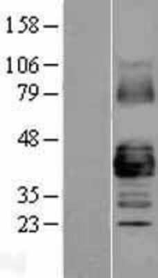 Western Blot: Connexin 43/GJA1 Overexpression Lysate [NBL1-11086]