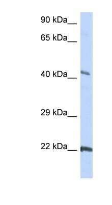 Western Blot: Connexin 45/GJC1 Antibody [NBP1-59282]