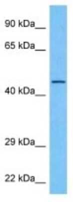 Western Blot: Connexin 46/GJA3 Antibody [NBP3-10869]