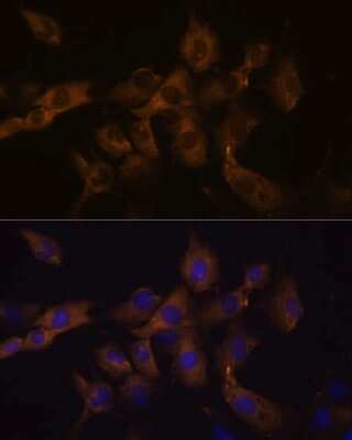 Immunocytochemistry/ Immunofluorescence: Connexin 50/GJA8 Antibody - Azide and BSA Free [NBP3-15748]