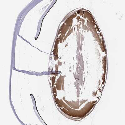 Immunohistochemistry: Connexin 50/GJA8 Antibody [NBP2-68589]