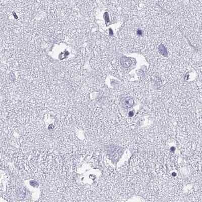 Immunohistochemistry-Paraffin: Connexin 50/GJA8 Antibody [NBP2-68589]