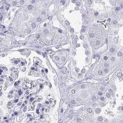 Immunohistochemistry-Paraffin: Connexin 50/GJA8 Antibody [NBP2-68589]