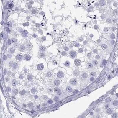 Immunohistochemistry-Paraffin: Connexin 50/GJA8 Antibody [NBP2-68589]