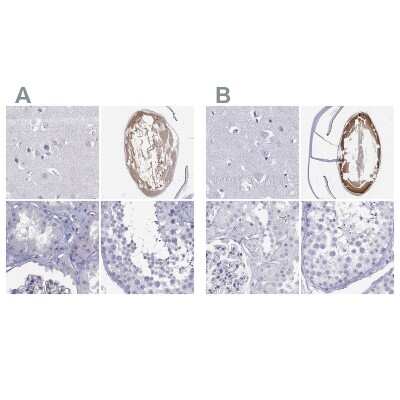 Immunohistochemistry-Paraffin: Connexin 50/GJA8 Antibody [NBP2-68799]