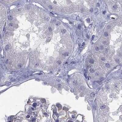 Immunohistochemistry-Paraffin: Connexin 50/GJA8 Antibody [NBP2-68799]