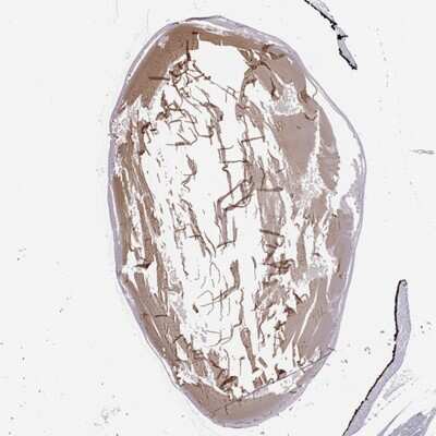 Immunohistochemistry-Paraffin: Connexin 50/GJA8 Antibody [NBP2-68799]