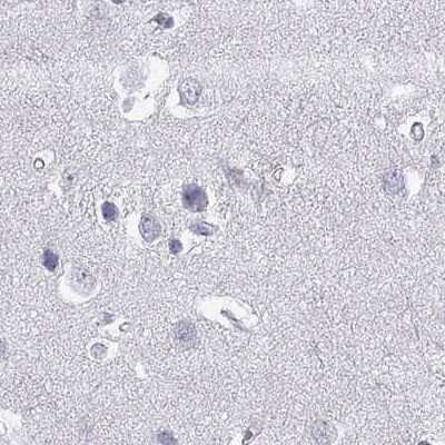 Immunohistochemistry-Paraffin: Connexin 50/GJA8 Antibody [NBP2-68799]