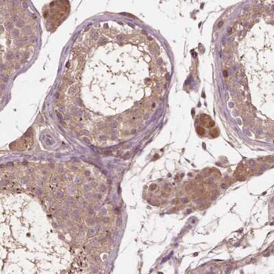 Immunohistochemistry-Paraffin: Connexin 58/GJA9 Antibody [NBP2-39088]