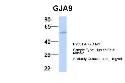 Western Blot: Connexin 58/GJA9 Antibody [NBP1-59196]