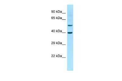 Western Blot: Connexin 62/GJA10 Antibody [NBP3-10396]