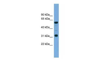 Western Blot: Connexin 62/GJA10 Antibody [NBP3-10556]