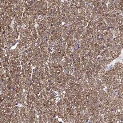 Immunohistochemistry: Contactin-1 Antibody [NBP2-68900]