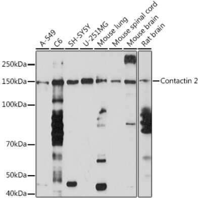 Western Blot: Contactin-2/TAG1 Antibody (4R2S3) [NBP3-16571]