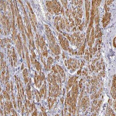 Immunohistochemistry: Contactin-2/TAG1 Antibody [NBP1-90055]